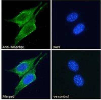 Immunocytochemistry/ Immunofluorescence: Perilipin-3/TIP47 Antibody [NBP1-06049]