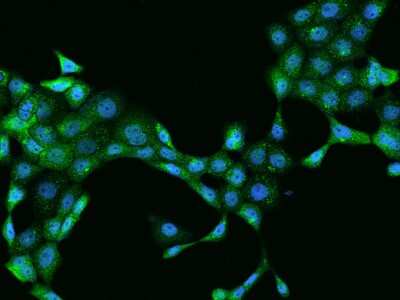 Immunocytochemistry/ Immunofluorescence: Perilipin-3/TIP47 Antibody [NBP2-97277]