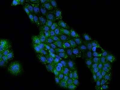 Immunocytochemistry/ Immunofluorescence: Perilipin-3/TIP47 Antibody [NBP2-98075]