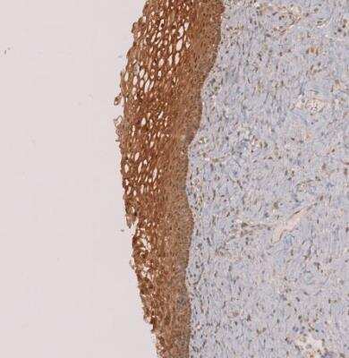 Immunohistochemistry-Paraffin: Perilipin-3/TIP47 Antibody [NBP1-87871]