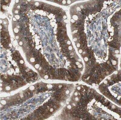 Immunohistochemistry-Paraffin: Perilipin-3/TIP47 Antibody [NBP1-87871]
