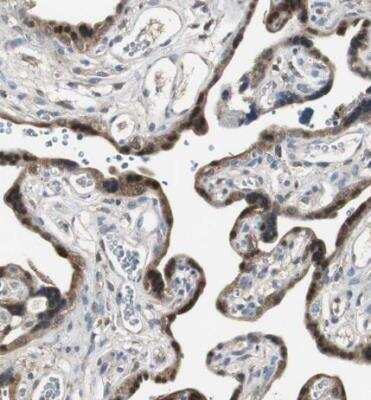 Immunohistochemistry-Paraffin: Perilipin-3/TIP47 Antibody [NBP1-87871]