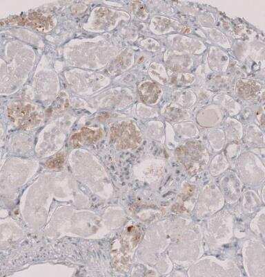 Immunohistochemistry-Paraffin: Perilipin-3/TIP47 Antibody [NBP1-87871]