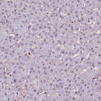 Immunohistochemistry-Paraffin: Perilipin-3/TIP47 Antibody [NBP2-49485]