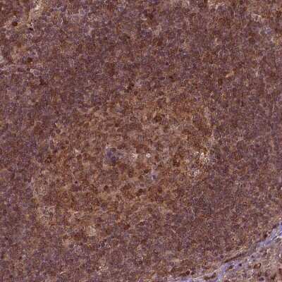 Immunohistochemistry-Paraffin: Perilipin-3/TIP47 Antibody [NBP2-49485]