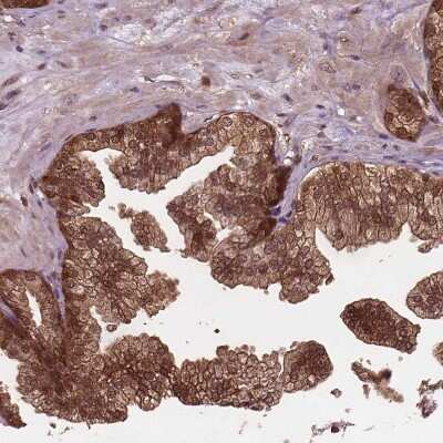 Immunohistochemistry-Paraffin: Perilipin-3/TIP47 Antibody [NBP2-49485]