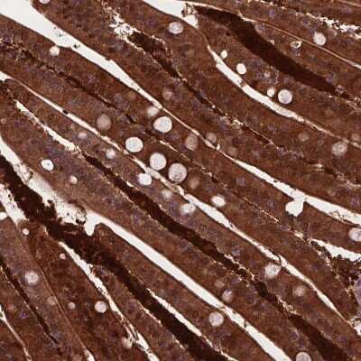 Immunohistochemistry-Paraffin: Perilipin-3/TIP47 Antibody [NBP2-49485]