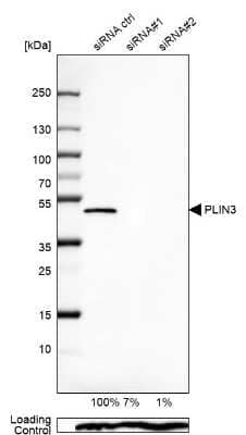 Western Blot: Perilipin-3/TIP47 Antibody [NBP2-49485]