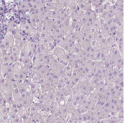 Immunohistochemistry-Paraffin: Perilipin-4 Antibody [NBP2-13776]