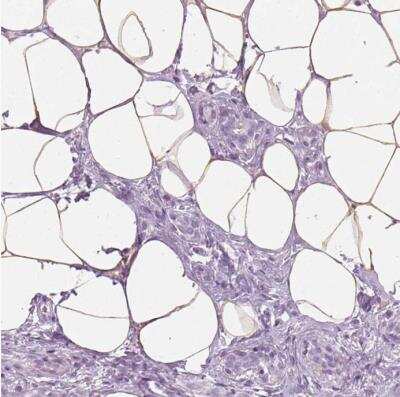 Immunohistochemistry-Paraffin: Perilipin-4 Antibody [NBP2-13776]