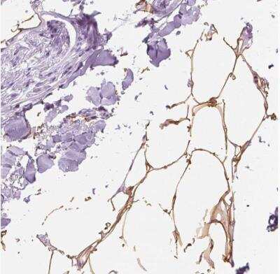 Immunohistochemistry-Paraffin: Perilipin-4 Antibody [NBP2-13776]