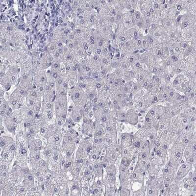 Immunohistochemistry-Paraffin: Perilipin-4 Antibody [NBP2-38731]