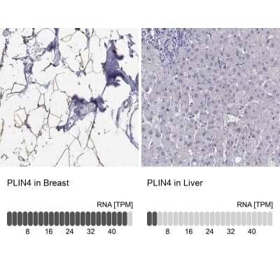 Immunohistochemistry-Paraffin: Perilipin-4 Antibody [NBP2-38731]