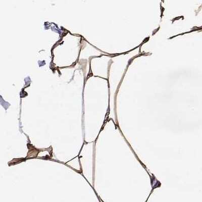 Immunohistochemistry-Paraffin: Perilipin-4 Antibody [NBP2-38731]