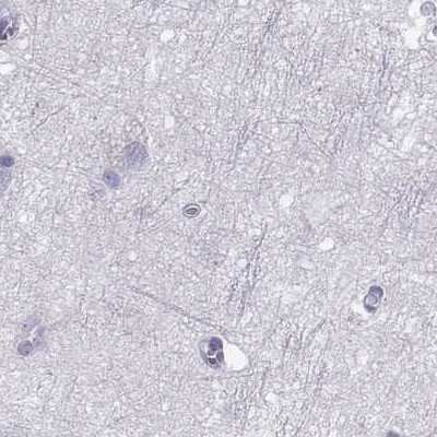 Immunohistochemistry-Paraffin: Perilipin-4 Antibody [NBP2-38731]