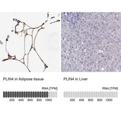Immunohistochemistry-Paraffin: Perilipin-4 Antibody [NBP2-38731]