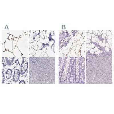 Immunohistochemistry-Paraffin: Perilipin-4 Antibody [NBP2-38731]