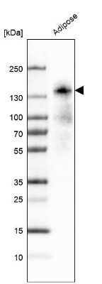 Western Blot: Perilipin-4 Antibody [NBP2-13776]