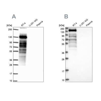 Western Blot: Perilipin-4 Antibody [NBP2-38731]