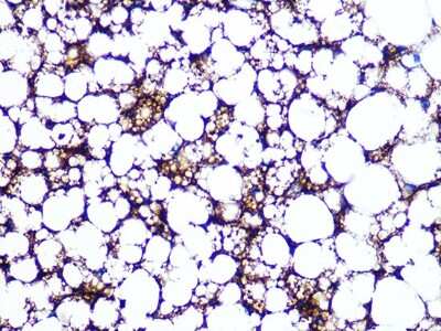 Immunohistochemistry-Paraffin: Perilipin Antibody (1K4W3) [NBP3-16480]