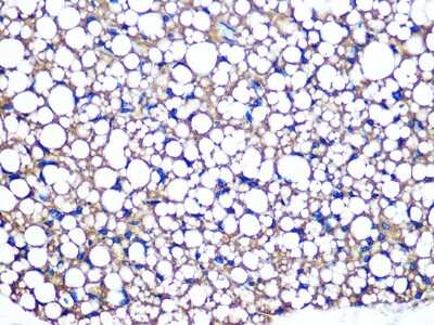 Immunohistochemistry-Paraffin: Perilipin Antibody (1K4W3) [NBP3-16480]