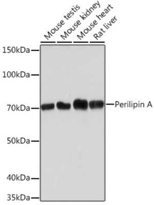 Western Blot: Perilipin Antibody (1K4W3) [NBP3-16480]