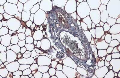 Immunohistochemistry-Paraffin: Perilipin Antibody (GT2781) [NBP3-13615]