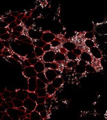 Imaging Mass Cytometry: Perilipin Antibody [NB110-40760]