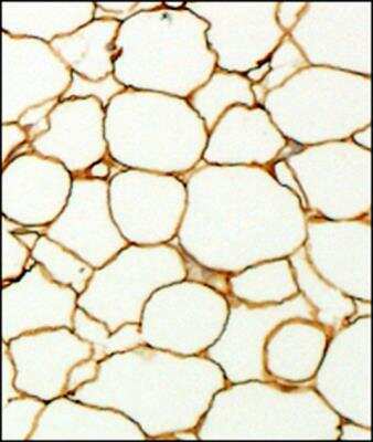 Immunohistochemistry-Paraffin: Perilipin Antibody [NB110-40760]