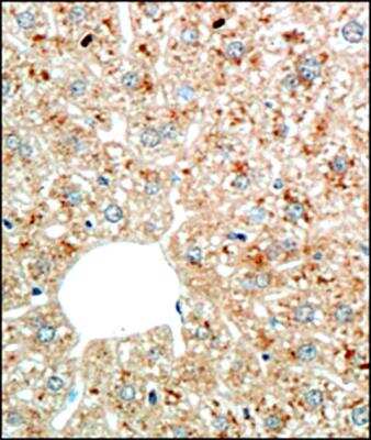 Immunohistochemistry-Paraffin: Perilipin Antibody [NB110-40760]