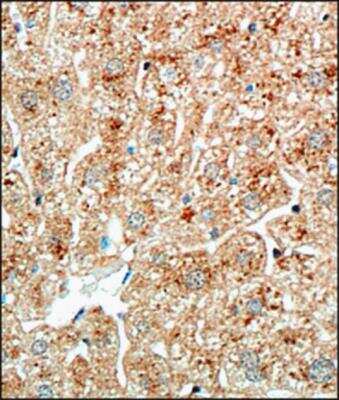 Immunohistochemistry-Paraffin: Perilipin Antibody [NB110-40760]