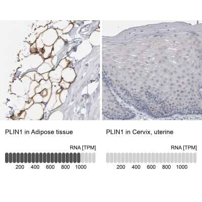 Immunohistochemistry-Paraffin: Perilipin Antibody [NBP1-87264]