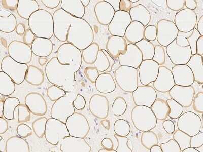 Immunohistochemistry-Paraffin: Perilipin Antibody [NBP2-99070]