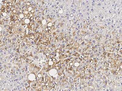 Immunohistochemistry-Paraffin: Perilipin Antibody [NBP2-99070]