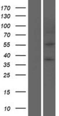 Western Blot: Perilipin Overexpression Lysate [NBP2-10847]