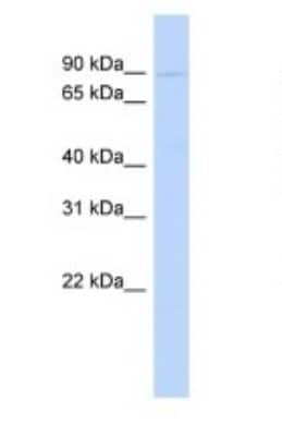 Western Blot: Periostin/OSF-2 Antibody [NBP1-59151]