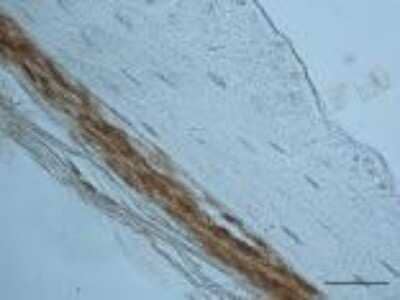 Immunohistochemistry: Periostin/OSF-2 Antibody - C-terminus - Azide and BSA Free [NBP1-30042]