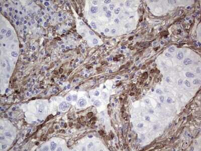 Immunohistochemistry: Periostin/OSF-2 Antibody (OTI2B2) [NBP2-45371]