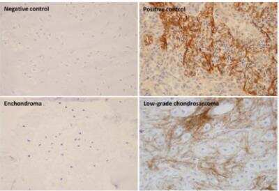 Immunohistochemistry: Periostin/OSF-2 Antibody (OTI2B2) [NBP2-45371]