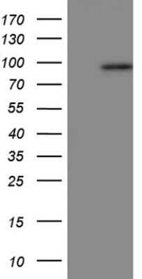 Western Blot: Periostin/OSF-2 Antibody (OTI2B2) [NBP2-45371]