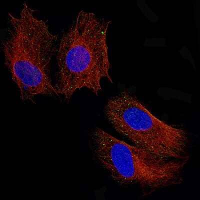 Immunocytochemistry/ Immunofluorescence: Periostin/OSF-2 Antibody (CL12087) [NBP3-15128]