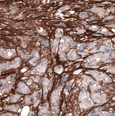 Immunohistochemistry-Paraffin: Periostin/OSF-2 Antibody (CL12087) [NBP3-15128]