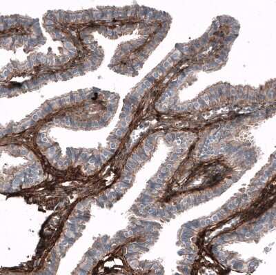 Immunohistochemistry-Paraffin: Periostin/OSF-2 Antibody (CL12087) [NBP3-15128]