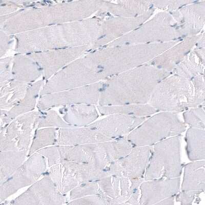 Immunohistochemistry-Paraffin: Periostin/OSF-2 Antibody (CL12087) [NBP3-15128]
