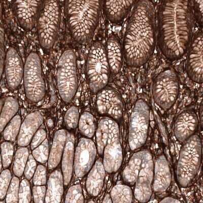 Immunohistochemistry-Paraffin: Periostin/OSF-2 Antibody (CL12087) [NBP3-15128]