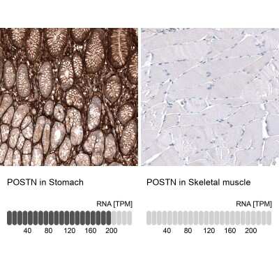 Immunohistochemistry-Paraffin: Periostin/OSF-2 Antibody (CL12087) [NBP3-15128]