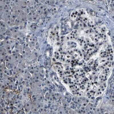 Immunohistochemistry-Paraffin: Periostin/OSF-2 Antibody [NBP1-82472]
