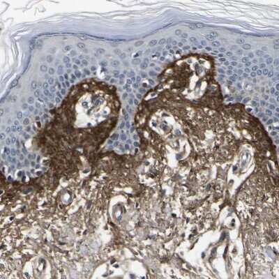 Immunohistochemistry-Paraffin: Periostin/OSF-2 Antibody [NBP1-82472]
