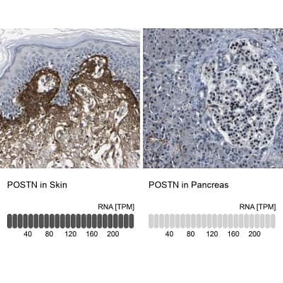 Immunohistochemistry-Paraffin: Periostin/OSF-2 Antibody [NBP1-82472]