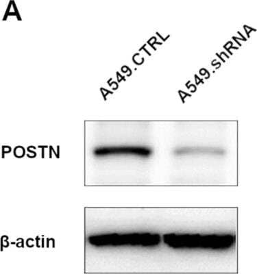 Knockdown Validated: Periostin/OSF-2 Antibody [NBP1-82472]